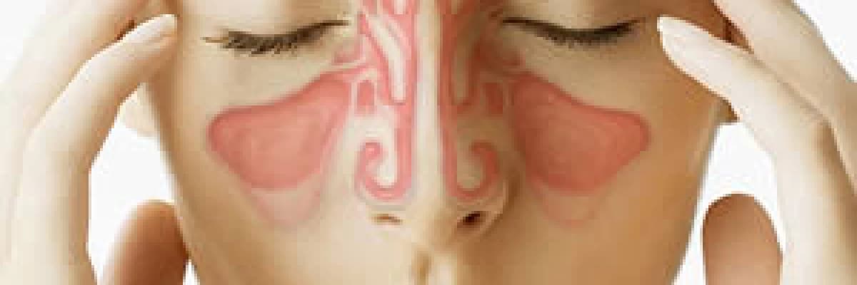 Sinüzit nedir?