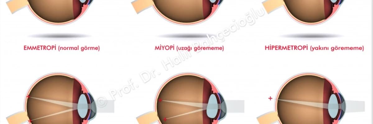 Kırma kusurları