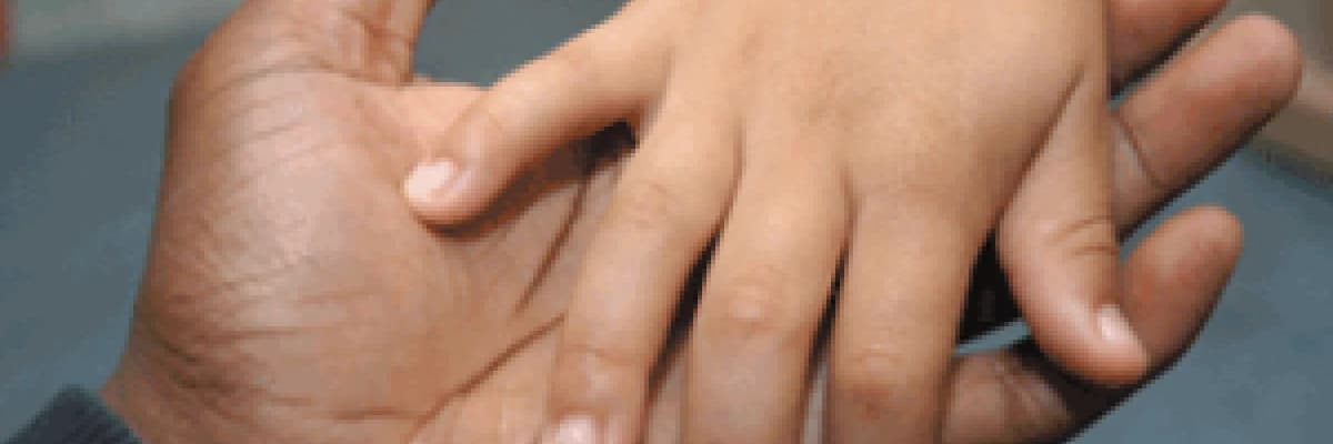 El cerrahisi Nedir?
