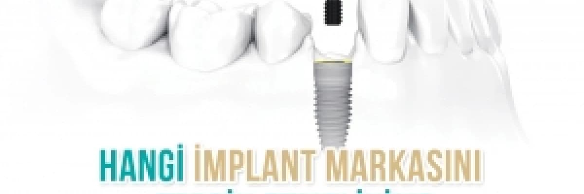 Hangi implant markası iyidir ?
