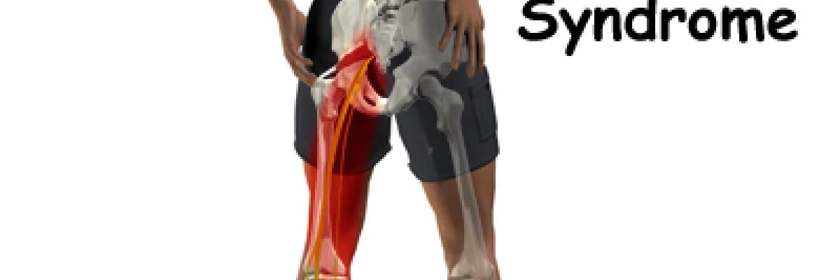 Piriformis sendromu