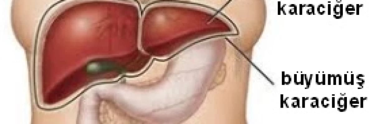 Çocuklarda karaciğer büyümesi