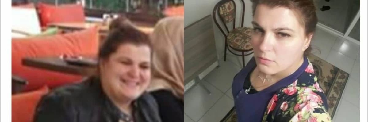 Obezitede cerrahi yöntem
