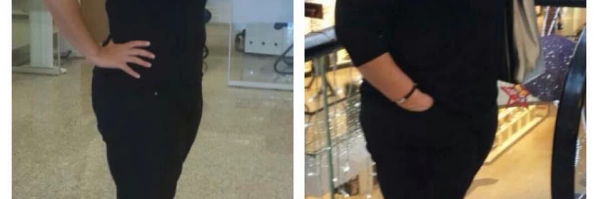 Obezite cerrahisi sonrası kafein tüketimi
