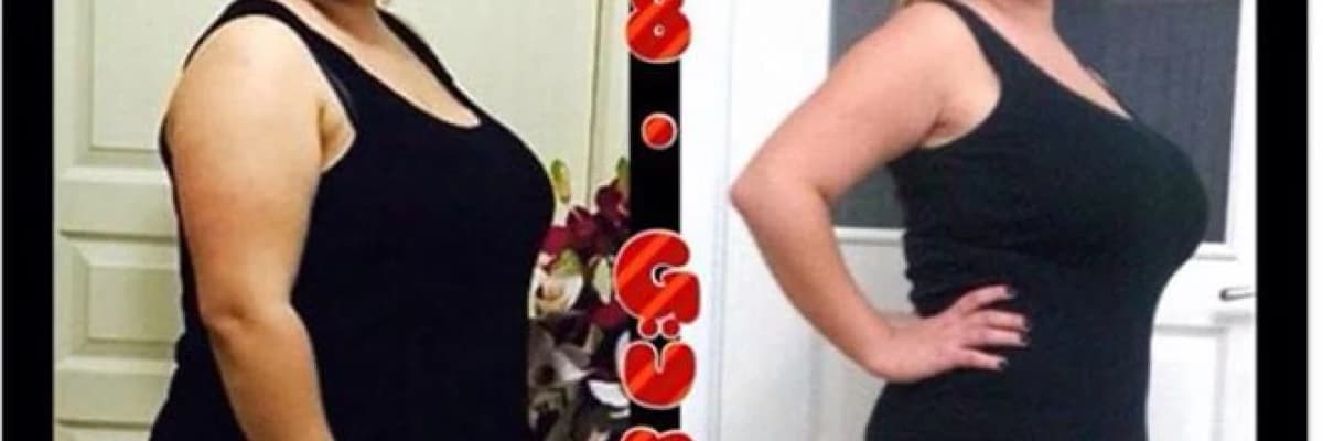Obezite ve gebelik