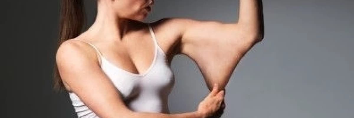 Kol liposuction ve kol germe