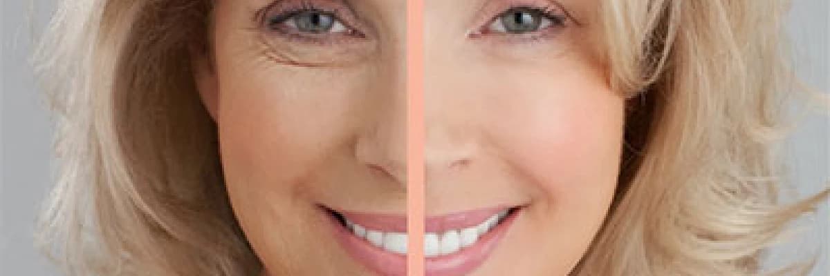Somon dna sı  pi sistem