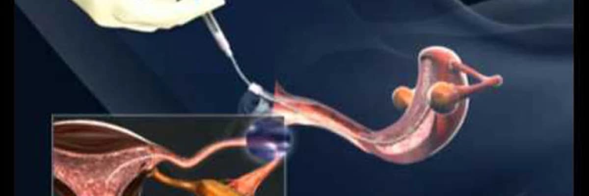 Aşılama (İnseminasyon)