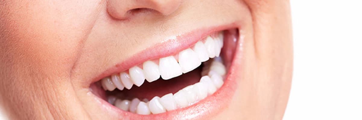 DENTAL  İMPLANT