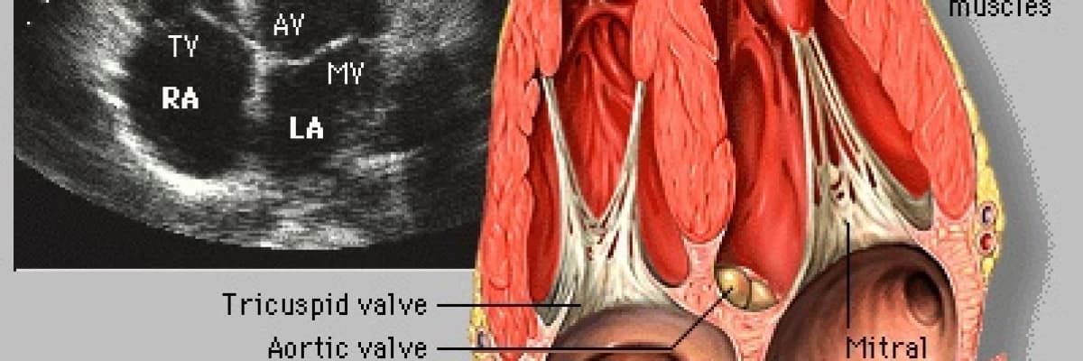 Fetal EKO