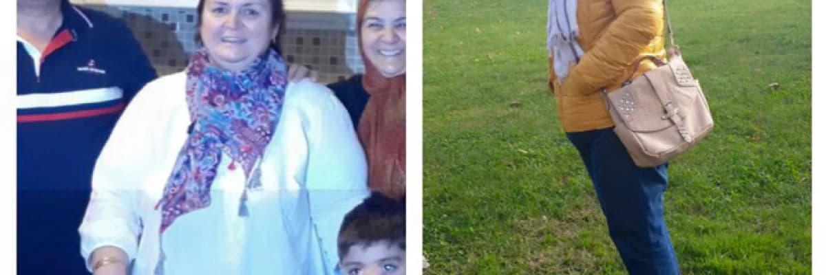 Morbid Obezite Nedir? Kimlere Morbid Obez Denir?
