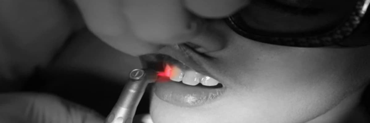 LAZER DESTEKLİ DİŞ HEKİMLİĞİ