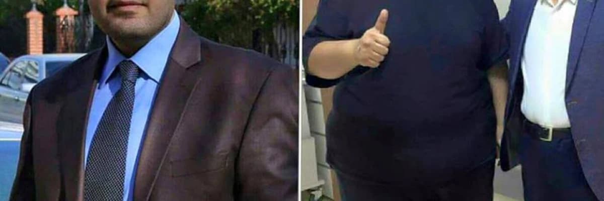 Obezite ve Kanser Arasındaki İlişkideki Biyolojik Mekanizmalar Nelerdir?