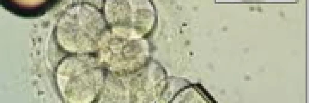 İnfertilite Ve Tüp Bebek