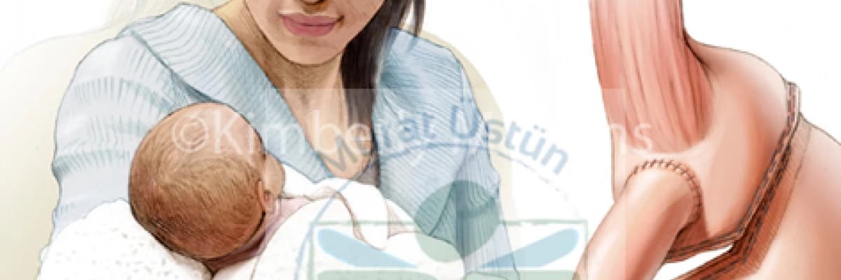 Obezite Cerrahisinden Sonra Gebelik ve Doğum Kontrolü