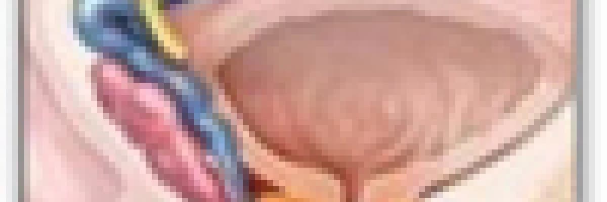 Prostat Kanseri ve Sebepleri nedir? Risk Faktörleri Nelerdir?