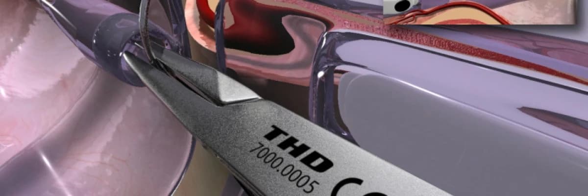 THD (TRANSANAL HEMOROİDAL DEARTERİLİZASYON MUKOPEXİ ) İLE HEMOROİD TEDAVİSİ