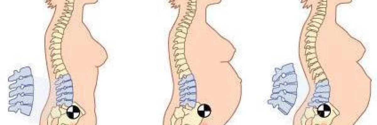 Gebelikte Sık Görülen Şikayetler- Bel Ağrıları