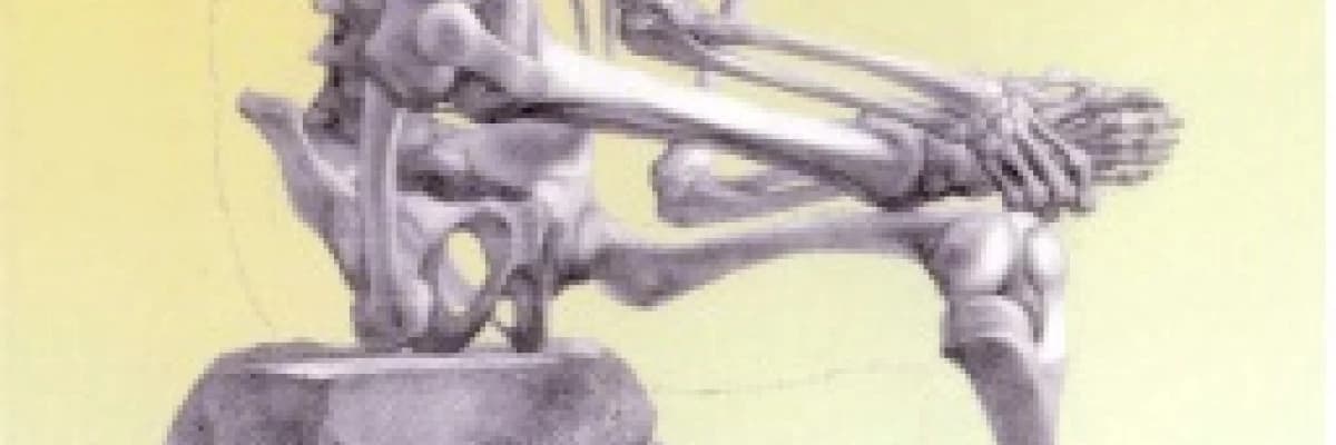 Topuk (kalkaeus) kırığı belirtileri, tedavisi başarısı ve sonuçları