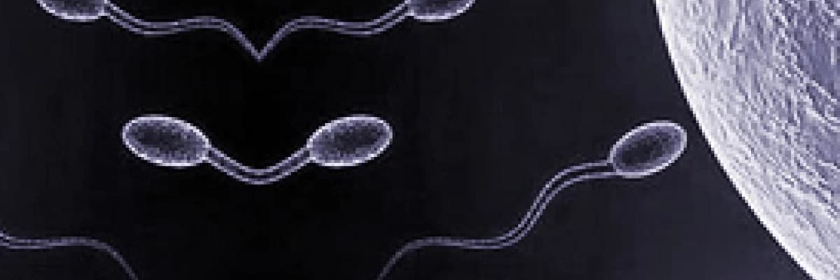 Azosperm nedir ? Nasıl Tedavi Edilir ?