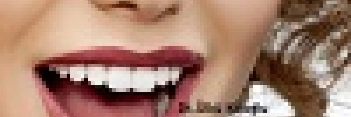 Porselen lamina avantajları