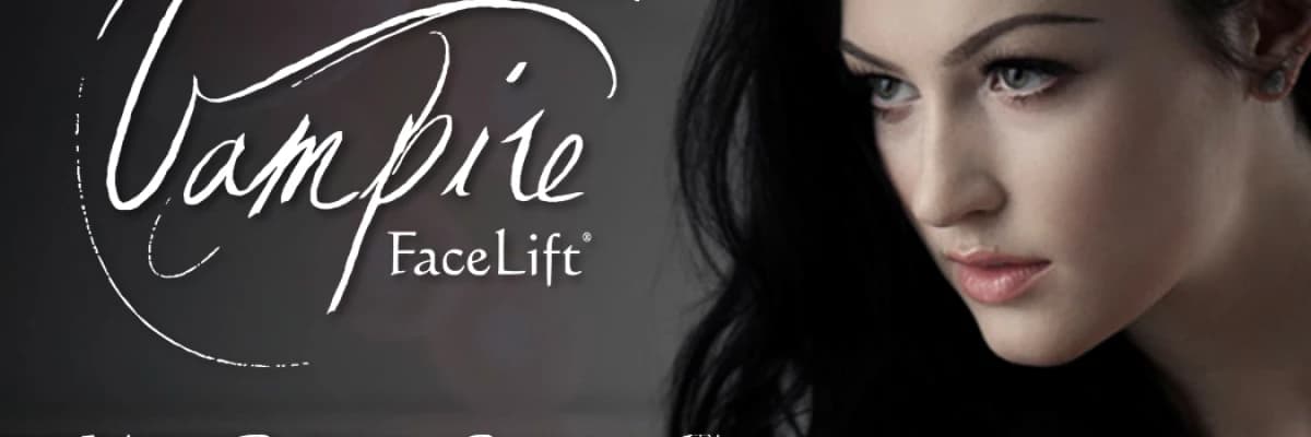 Vampire Facelift