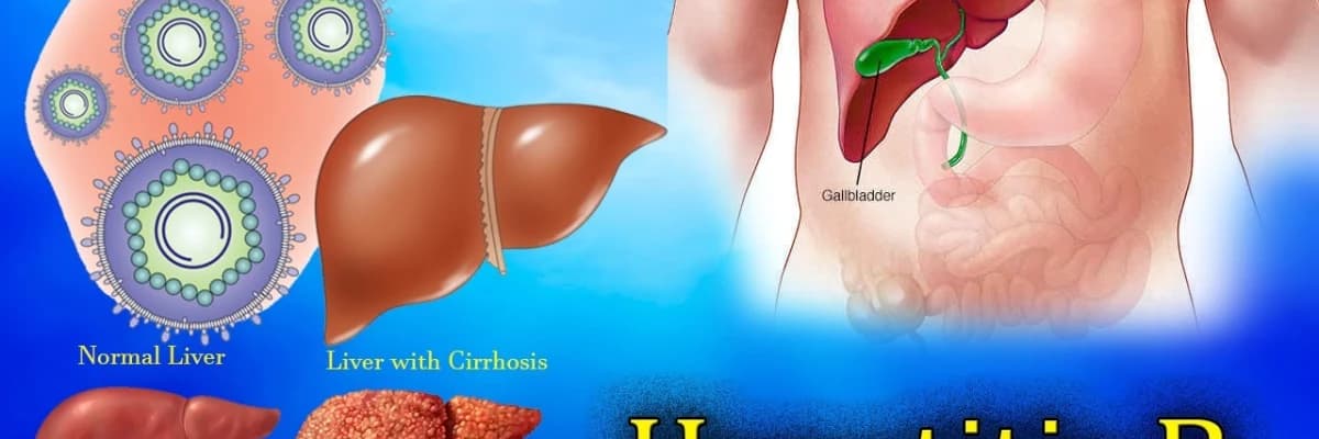 Sinsi Bir Hastalık Hepatitler  Siz de Hepatit Hastası mısınız?