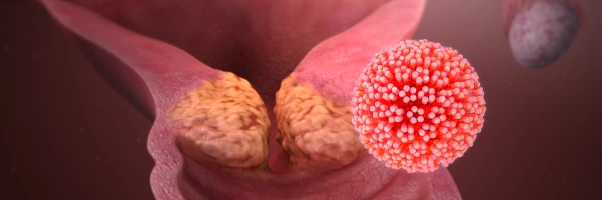 HPV( Human Papilloma Virüs) Enfeksiyonu ve Korunma