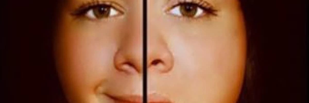 Bipolar Bozukluk - İki Uçlu Mizaç Bozukluğu