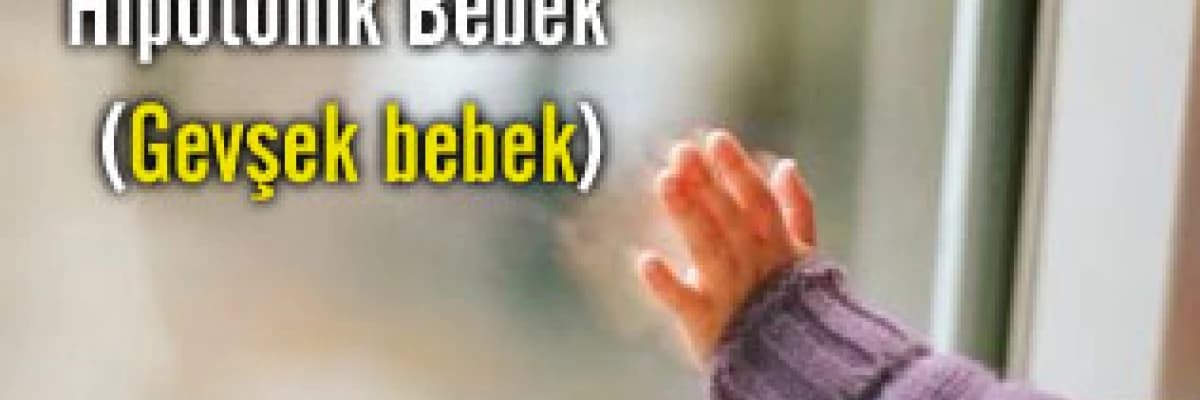 Hipotonik bebek