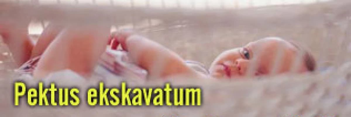 Pektus ekskavatum (kunduracı göğsü)