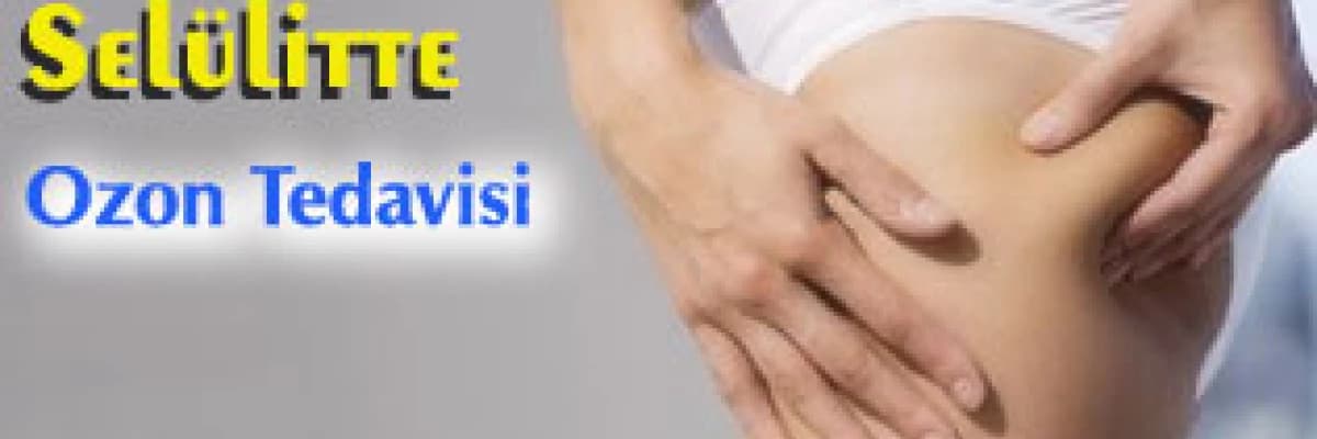 Selülitte ozon tedavisi