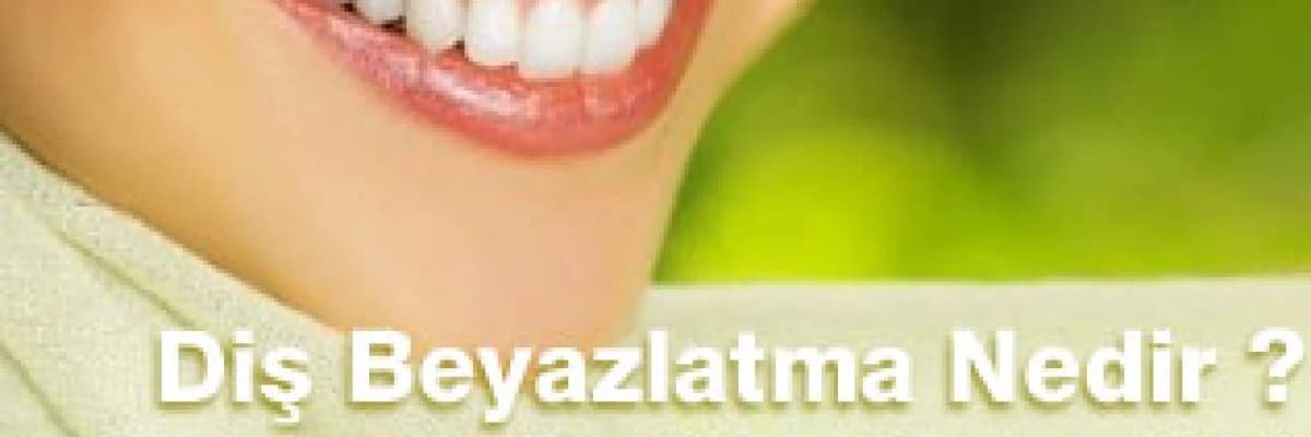 Diş Beyazlatma Nedir ? Kimlere Uygulanabilir ?