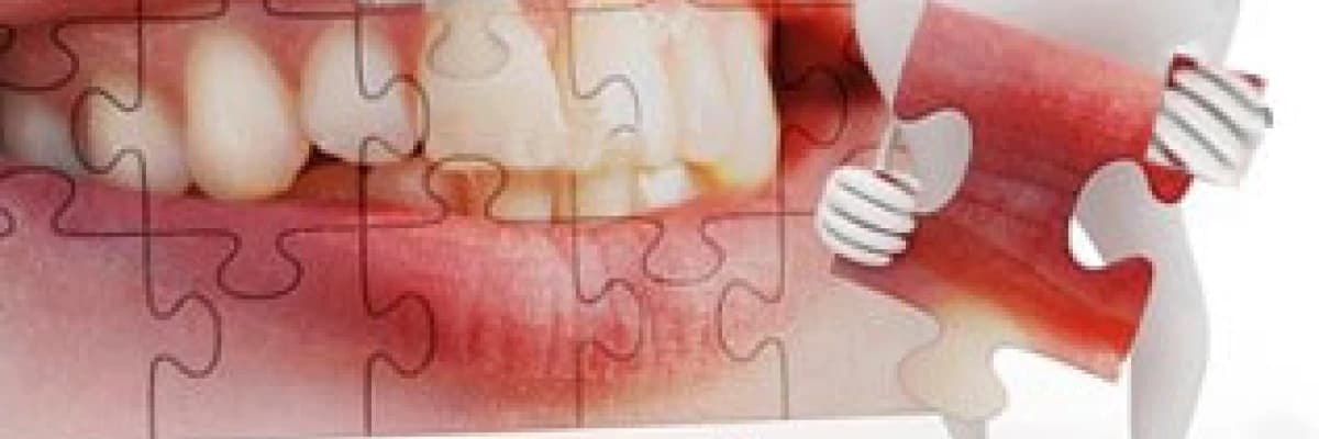 Diş implantları!