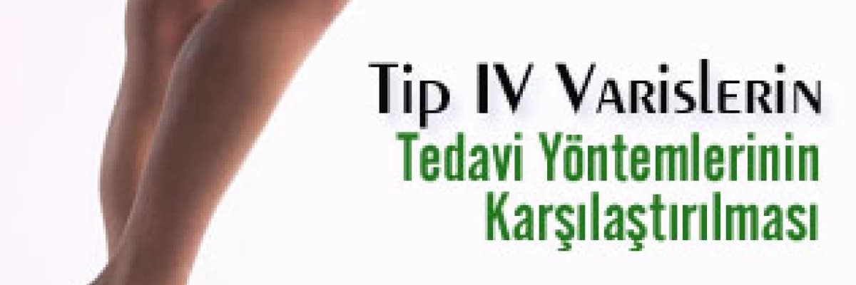 Tip IV Varislerin Tedavi Yöntemlerinin Karşılaştırılması