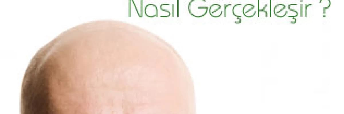 Saç Ekim Operasyonu Nasıl Gerçekleşir ?