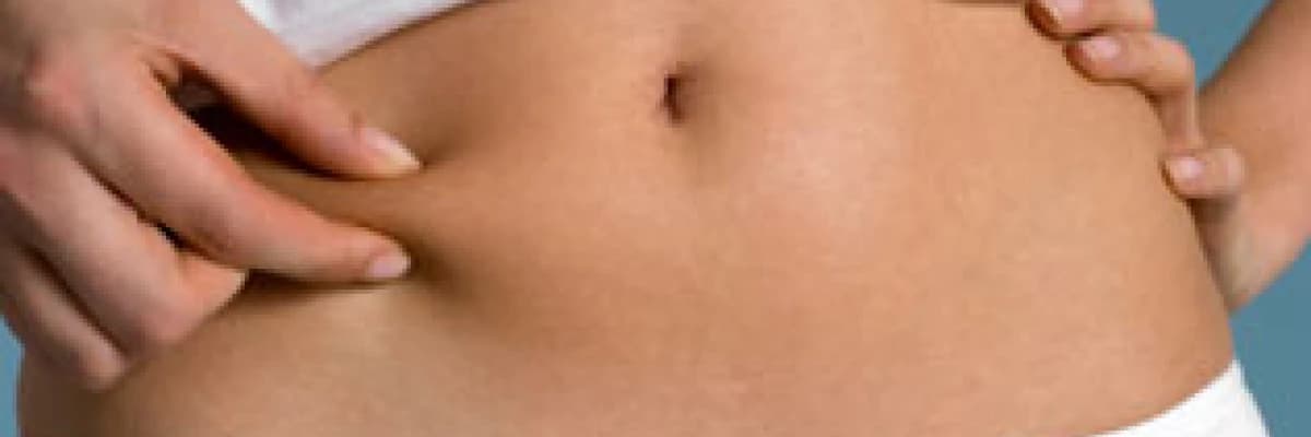 Abdominoplasti