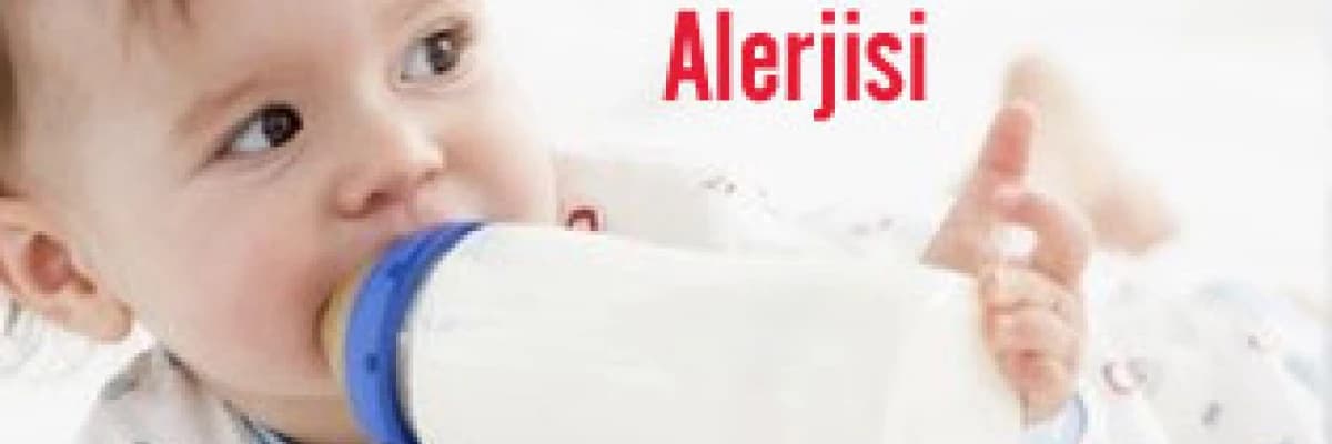 İnek sütü allerjisi