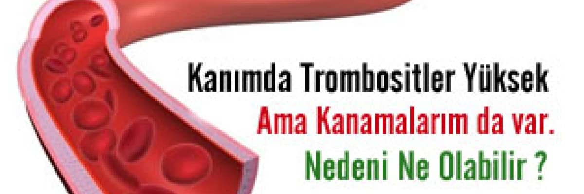 Kanımda Trombositler Yüksek Ama Kanamalarım da var. Nedeni Ne Olabilir?