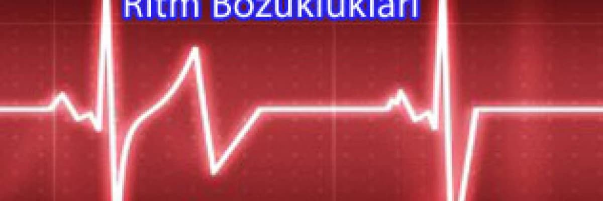 Ritm Bozuklukları