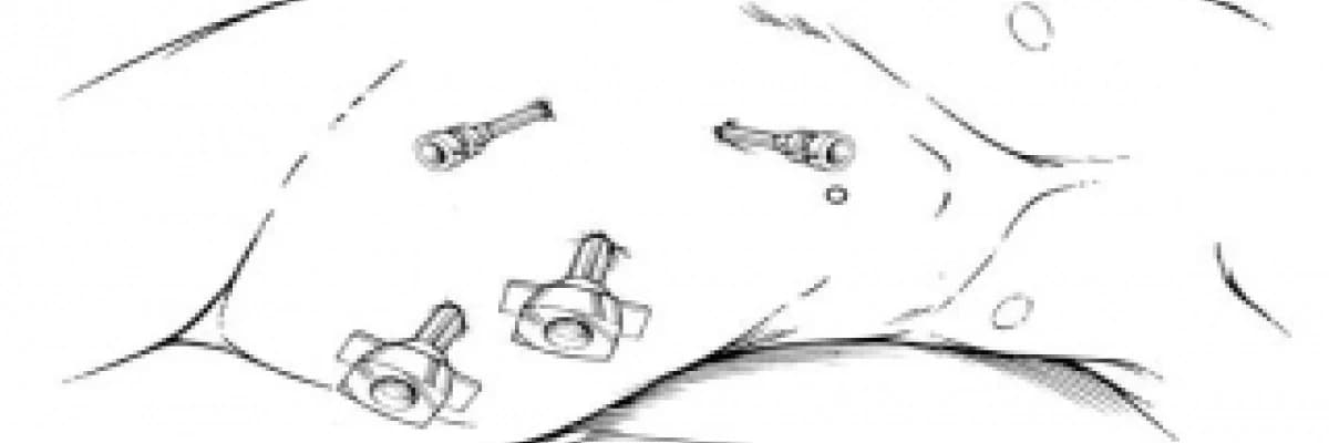 Böbrek kanseri Robot ve Laparoskopi ile tedavisi