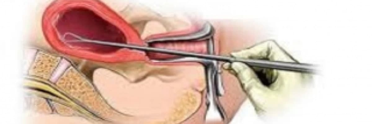 Kürtaj Nedir,Kimler Kürtaj olabilir?