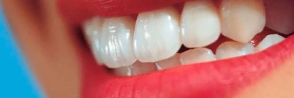 Diş ağartmada  (bleaching)  güncel bilgiler