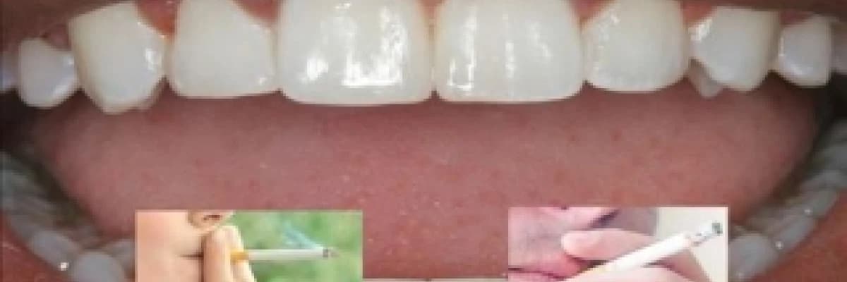 SİGARA ÖNCE DİŞLERİ ETKİLİYOR