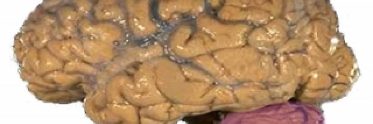 BAŞĞARISI MİGREN GERİLİM BAŞAĞRISI SİNUZİT TANSİYON