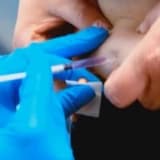 Beta [HCG] Diyetleri