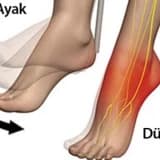 Düşük ayak
