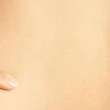 Karın germe ameliyatı (tummy-tuck)