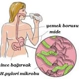 Çocuklarda mide mikrobu (helicobacter pylori)
