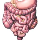 Ülseratif kolit ve crohn hastalığı